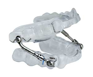 Sleep Disorder Appliance